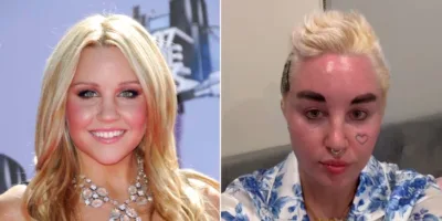 Picture 10 Celebrities Who Have Transformed Dramatically Over the Years