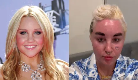 Picture 10 Celebrities Who Have Transformed Dramatically Over the Years