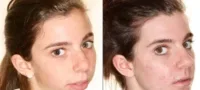 Picture 10 Wild Cosmetic Surgeries People Actually Get Done
