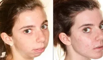 Picture 10 Wild Cosmetic Surgeries People Actually Get Done