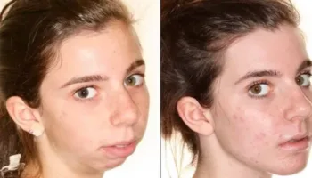 Picture 10 Wild Cosmetic Surgeries People Actually Get Done