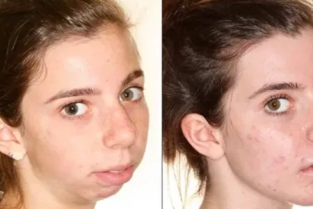 Picture 10 Wild Cosmetic Surgeries People Actually Get Done