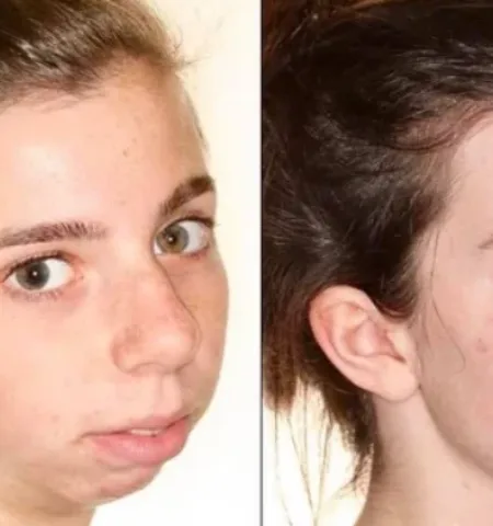 Picture 10 Wild Cosmetic Surgeries People Actually Get Done