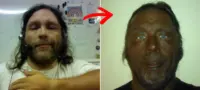 Picture Man’s Dramatic 17-Year Transformation After Using Unregulated Injection Raises Health Warnings