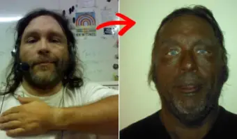 Picture Man’s Dramatic 17-Year Transformation After Using Unregulated Injection Raises Health Warnings