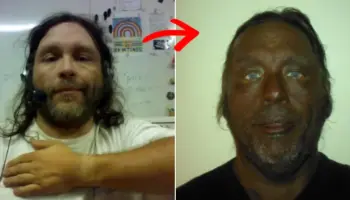Picture Man’s Dramatic 17-Year Transformation After Using Unregulated Injection Raises Health Warnings