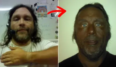 Picture Man’s Dramatic 17-Year Transformation After Using Unregulated Injection Raises Health Warnings
