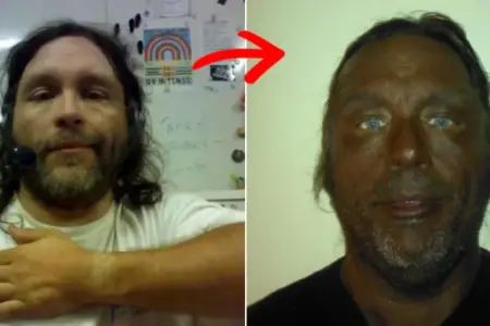 Picture Man’s Dramatic 17-Year Transformation After Using Unregulated Injection Raises Health Warnings