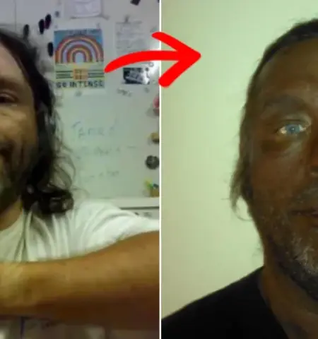 Picture Man’s Dramatic 17-Year Transformation After Using Unregulated Injection Raises Health Warnings