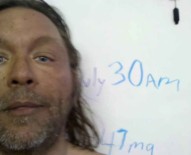 Melanotan