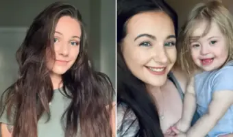 Picture Woman Diagnosed with Down Syndrome at 23 After a Series of Unexpected Test Results