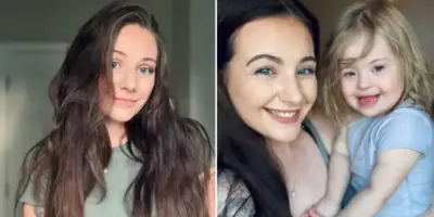 Picture Woman Diagnosed with Down Syndrome at 23 After a Series of Unexpected Test Results