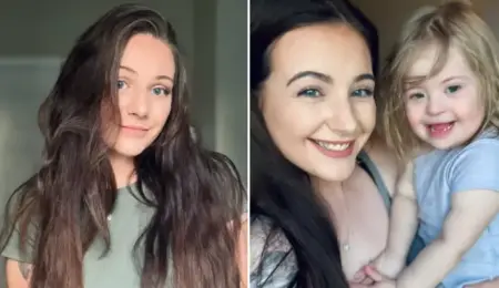 Picture Woman Diagnosed with Down Syndrome at 23 After a Series of Unexpected Test Results