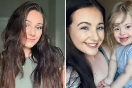 Picture Woman Diagnosed with Down Syndrome at 23 After a Series of Unexpected Test Results