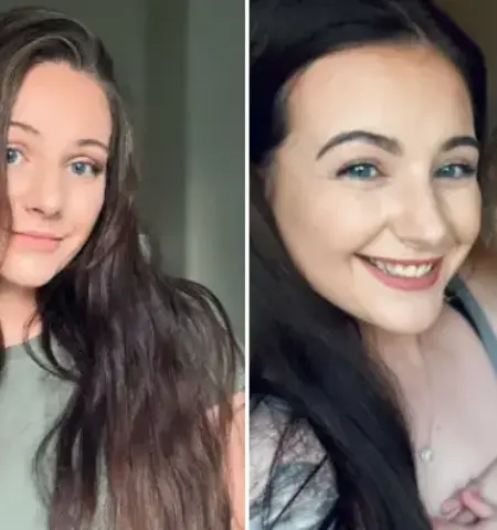 Picture Woman Diagnosed with Down Syndrome at 23 After a Series of Unexpected Test Results